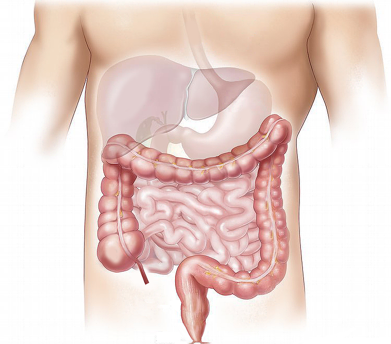 Problemas com Intestino na Dieta a base de Carnes, Leites e derivados proporciona doenças